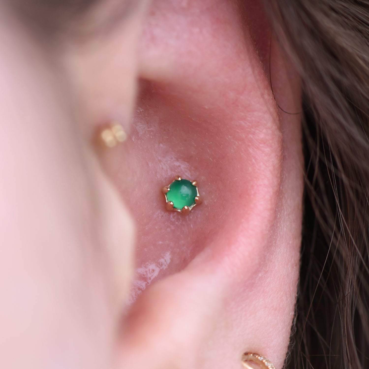 Amulet - Threadless End