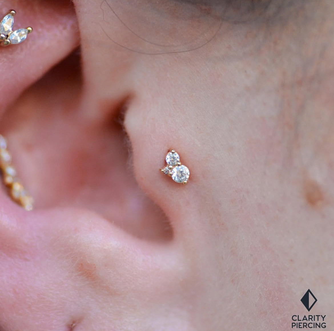 Glitch - Threadless End